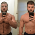 Before and After Testosterone Therapy